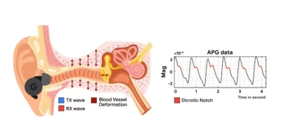 Side-view illustration of the ear and the ear canal, with an earbud plugged in, showing soundwaves travelling in the canal, and indicating deformation taking place due to heart beats.