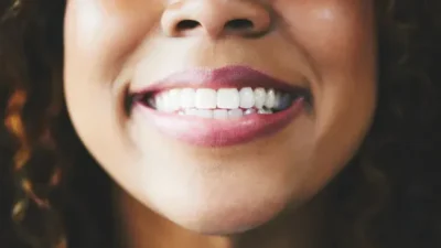 Keratin extracted from sheep's wool repairs teeth in breakthrough 3 Close view ofa woman's mouth showing white shiny teeth as she smiles.